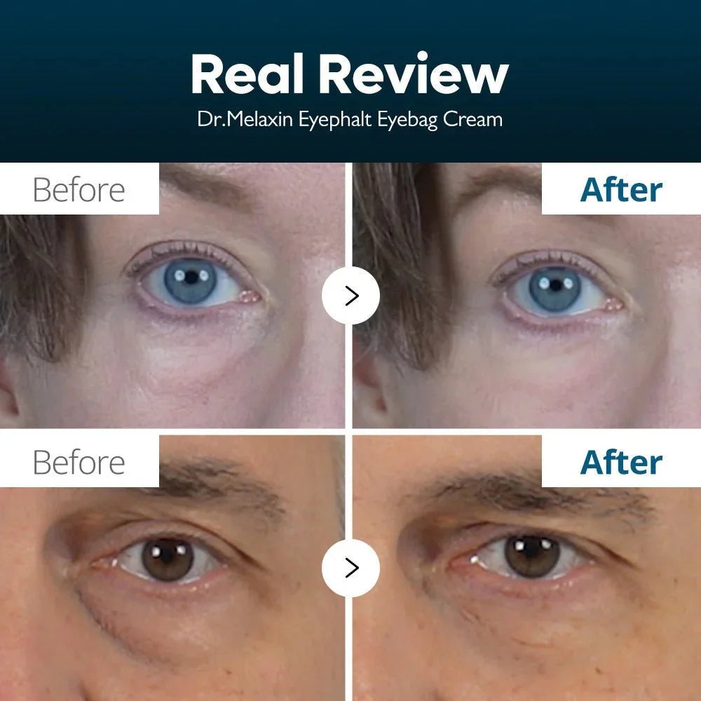 Dr. Melaxin - Eyephalt Eyebag Cream [10ml]