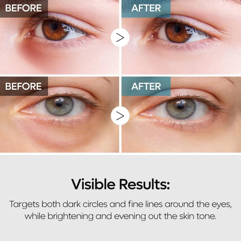 Dr. Melaxin - TX Retinalsome Double Effect Eye Cream [40g]