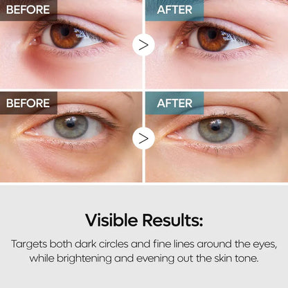 Dr. Melaxin - TX Retinalsome Double Effect Eye Cream [40g]