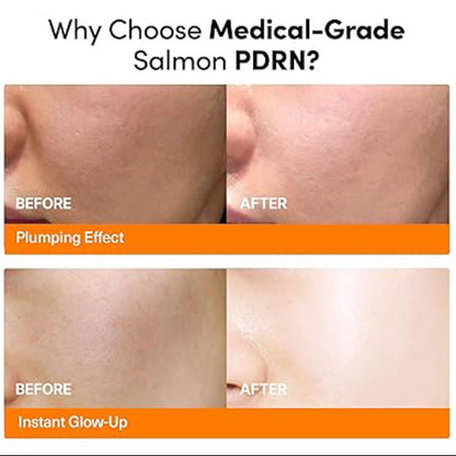 FRANKLY - PDRN Bounce Ball Serum [30ml] - Youglow