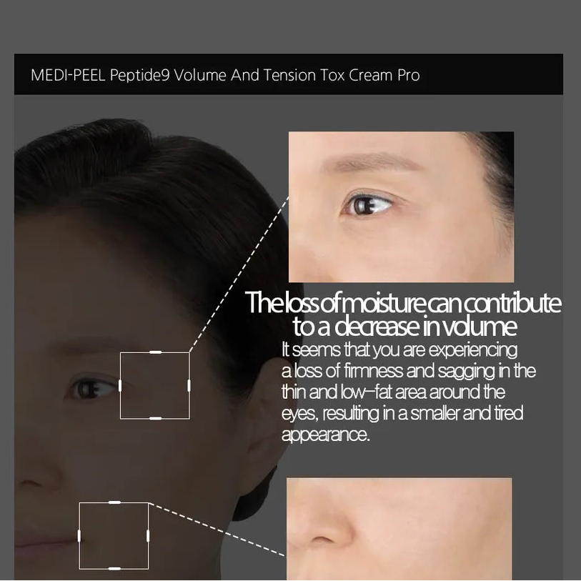 MEDIPEEL - Peptide 9 Volume &amp; Tension Tox Cream Pro [50g]