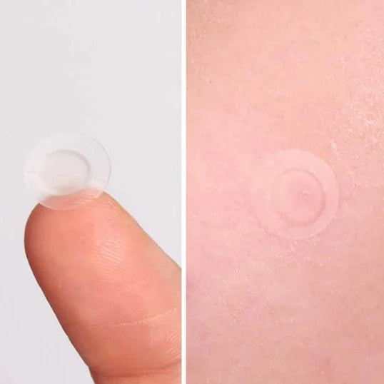 Pyunkang Yul - Acne Spot Patch Super Thin [15 patch/ sheet]