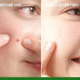 Troubless - Invisible Plus Spot Patch The Red Correct [96 patch] - Youglow