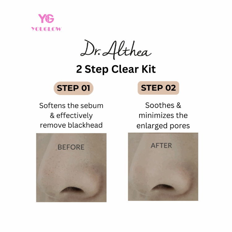 Dr. Althea - Blackhead Zero 2 Step Nose Patch [4 patches]