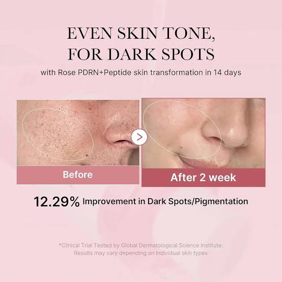 medicube- PDRN Pink Niacinamide Milky Toner [150ml]