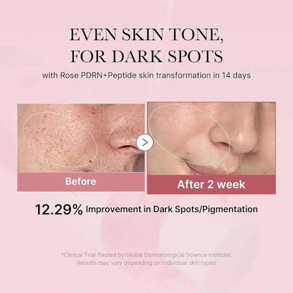 medicube- PDRN Pink Niacinamide Milky Toner [150ml]